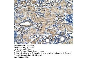Human kidney (Aspartate beta Hydroxylase antibody  (N-Term))
