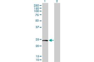 Western Blot analysis of PTTG2 expression in transfected 293T cell line by PTTG2 MaxPab polyclonal antibody. (PTTG2 antibody  (AA 1-191))