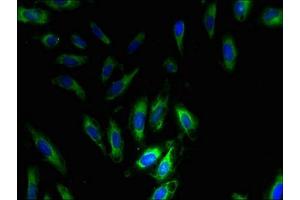 Immunofluorescent analysis of Hela cells using ABIN7169869 at dilution of 1:100 and Alexa Fluor 488-congugated AffiniPure Goat Anti-Rabbit IgG(H+L) (SNRPG antibody  (AA 1-76))
