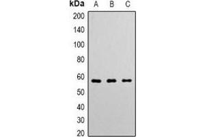 Western blot analysis of Angiopoietin-1 expression in K562 (A), Hela (B), Jurkat (C) whole cell lysates. (Angiopoietin 1 antibody  (N-Term))