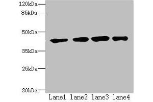 Western blot All lanes: QTRT1 antibody at 6 μg/mL Lane 1: MCF-7 whole cell lysate Lane 2: PC-3 whole cell lysate Lane 3: Jurkat whole cell lysate Lane 4: A431 whole cell lysate Secondary Goat polyclonal to rabbit IgG at 1/10000 dilution Predicted band size: 45, 25 kDa Observed band size: 45 kDa (QTRT1 antibody  (Catalytic Subunit 1))