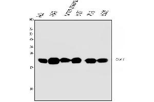 Western blot analysis of Caveolin-1/CAV1 using anti-Caveolin-1/CAV1 antibody (ABIN6719534).