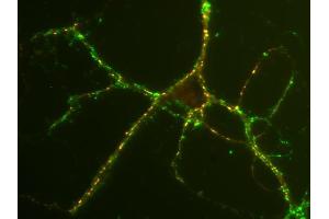 Immunostaining of rat hippocampus neurons with anti-SV2 C (red; dilution: 1 : 500) and anti-synaptophysin (cat. (SV2C antibody  (AA 2-16))