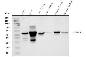 Western blot analysis of ADH1A using anti-ADH1A antibody (ABIN4886427).