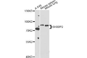 Western blot analysis of extracts of various cell lines, using SH3BP2 antibody (ABIN5998800) at 1/1000 dilution.