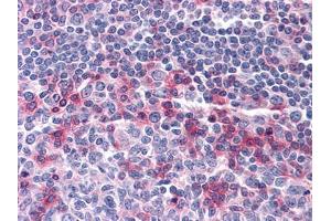 Immunohistochemical analysis of paraffin-embedded human Tonsil tissues using anti-CD69 mouse mAb (CD69 antibody)