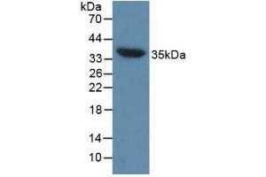 Detection of AQP4 in Mouse Heart Tissue using Polyclonal Antibody to Aquaporin 4 (AQP4) (Aquaporin 4 antibody  (AA 177-304))