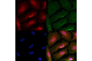 ABIN6263700 and ABIN6266787 staining  cells by IF/ICC.