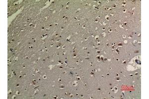 Immunohistochemistry (IHC) analysis of paraffin-embedded Human Brain, antibody was diluted at 1:100. (Tumor Protein p73 antibody  (acLys321))