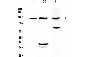 Western blot analysis of MUC1 using anti-MUC1 antibody . (MUC1 antibody  (AA 1062-1139))