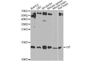 Western blot analysis of extracts of various cell lines, using VIP Antibody. (Vip antibody  (AA 31-170))