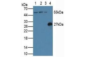 Western blot analysis of (1) Human Jurkat Cells, (2) Human HeLa cells, (3) Human K562 Cells and (4) Rat Spleen Tissue. (FLIP antibody  (AA 43-281))