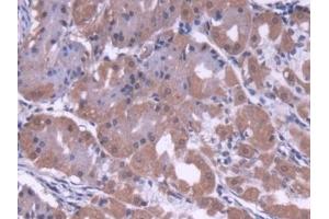 Detection of COVA1 in Human Stomach Tissue using Polyclonal Antibody to Cytosolic Ovarian Carcinoma Antigen 1 (COVA1) (ENOX2 antibody  (AA 1-207))