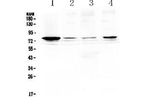 Western blot analysis of RANK using anti-RANK antibody .