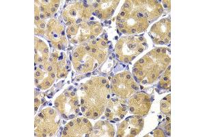 Immunohistochemistry of paraffin-embedded human stomach using UBIAD1 antibody at dilution of 1:100 (40x lens).