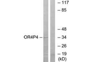 Western blot analysis of extracts from HeLa cells, using OR4P4 Antibody.