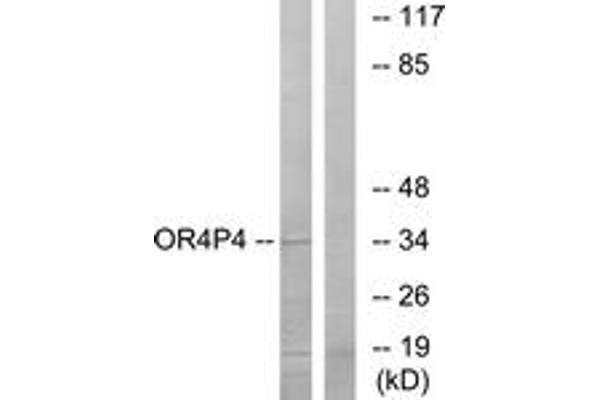 OR4P4 抗体  (AA 260-309)