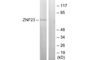 Western blot analysis of extracts from LOVO cells, using ZNF23 antibody. (ZNF23 antibody)