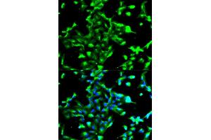 Immunofluorescence analysis of A549 cell using ANXA2 antibody. (Annexin A2 antibody)