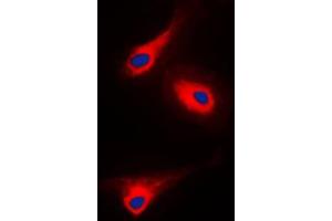 Immunofluorescent analysis of PLC gamma 1 (pY1253) staining in A431 cells. (Phospholipase C gamma 1 antibody  (C-Term, pTyr1253))