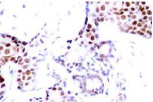 Image no. 1 for anti-ELK1, Member of ETS Oncogene Family (ELK1) (pSer389) antibody (ABIN318013) (ELK1 antibody  (pSer389))