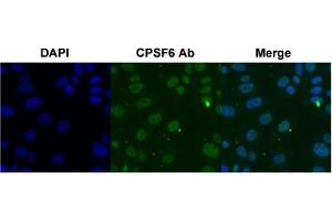 Immunofluorescent staining of SK-OV-3 cell with CPSF6 polyclonal antibody  under 4 ug/mL working concentration. (CPSF6 antibody  (AA 261-310))