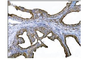 IHC analysis of DLGAP1 using anti-DLGAP1 antibody (ABIN7600257). (DLGAP1 antibody  (AA 17-319))