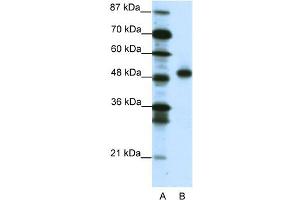 WB Suggested Anti-MEOX2 Antibody Titration:  1. (MEOX2 antibody  (C-Term))