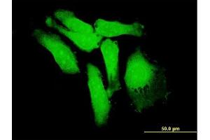 Immunofluorescence of purified MaxPab antibody to S100P on HeLa cell. (S100P antibody  (AA 1-95))