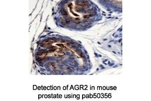 Image no. 3 for anti-Anterior Gradient Homolog 2 (Xenopus Laevis) (AGR2) (AA 1-50), (N-Term) antibody (ABIN363665)