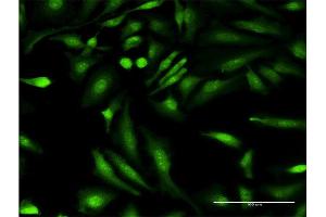 Immunofluorescence of monoclonal antibody to HGD on HeLa cell. (HGD antibody  (AA 377-445))
