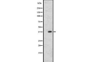 Western blot analysis of CCR1 expression in A431 whole cell lysate ,The lane on the left is treated with the antigen-specific peptide. (CCR1 antibody  (N-Term))