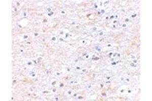 Immunohistochemical staining of human brain tissue using AP30926PU-N at 2. (FNBP1L antibody  (N-Term))