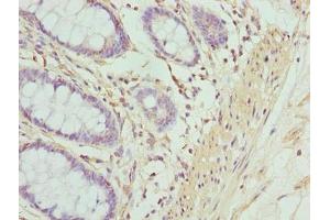 Immunohistochemistry of paraffin-embedded human colon tissue using ABIN7143144 at dilution of 1:100 (ACTG2 antibody  (AA 181-376))