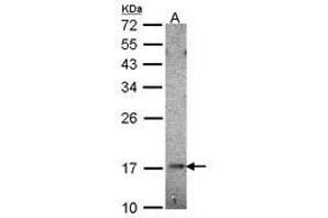 Image no. 2 for anti-Ubiquitin-Conjugating Enzyme E2B (UBE2B) (AA 7-152) antibody (ABIN467405) (UBE2B antibody  (AA 7-152))