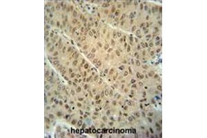 DCAF10 antibody  (N-Term)