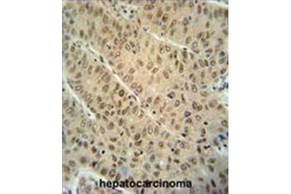 DCAF10 antibody  (N-Term)