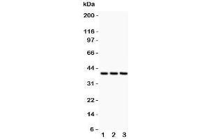 Western blot testing of CXCR6 antibody and  Lane 1: HeLa;  2: Jurkat;  3: MCF-7 lysate. (CXCR6 antibody  (C-Term))