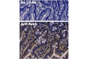 Immunohistochemistry (IHC) image for anti-RAB1A, Member RAS Oncogene Family (RAB1A) (C-Term) antibody (ABIN1440053) (RAB1A antibody  (C-Term))