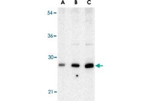 Western blot analysis of BCAP29 in human heart tissue lysate with BCAP29 polyclonal antibody  at (A) 0. (BCAP29 antibody  (Internal Region))