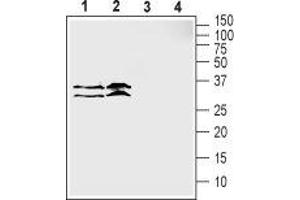 SLC39A3 antibody  (1st Extracellular Loop)