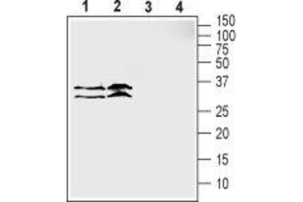 SLC39A3 antibody  (1st Extracellular Loop)