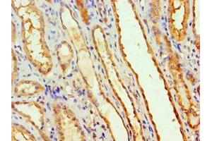 Immunohistochemistry of paraffin-embedded human kidney tissue using ABIN7160641 at dilution of 1:100 (MTMR14 antibody  (AA 1-280))