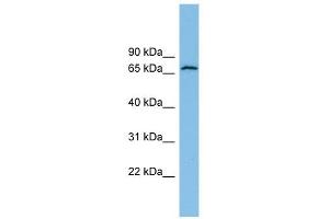 GLUD2 antibody used at 1 ug/ml to detect target protein. (GLUD2 antibody  (N-Term))