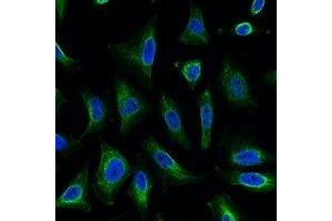 Immunofluorescent analysis of Aquaporin 4 staining in Hela cells. (Aquaporin 4 antibody)