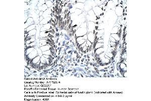 Human Stomach (MKX antibody  (Middle Region))