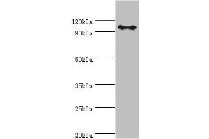 Western blot All lanes: AP-2 complex subunit beta antibody at 8 μg/mL + Mouse brain tissue Secondary Goat polyclonal to rabbit IgG at 1/10000 dilution Predicted band size: 105, 106, 99 kDa Observed band size: 105 kDa (AP2B1 antibody  (AA 738-937))