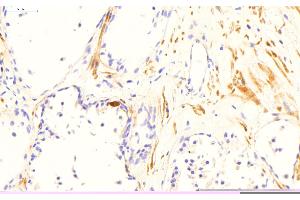Sample Type: Normal Human Prostate Primary Antibody Dilution: 2 µg/mL Color/Signal Descriptions: TGM4 (DAB; brown), nuclei (hematoxylin; blue)  Gene Name: TGM4 (TGM4 antibody  (N-Term))