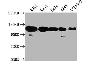 Western Blot Positive WB detected in: K562 whole cell lysate, Raji whole cell lysate, Hela whole cell lysate, A549 whole cell lysate, NTERA-2 whole cell lysate All lanes: PARP1 antibody at 1:2000 Secondary Goat polyclonal to rabbit IgG at 1/50000 dilution Predicted band size: 114 kDa Observed band size: 114 kDa (PARP1 antibody  (AA 324-541))