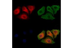ABIN6264415 and ABIN6278511 staining Hela cells by IF/ICC. (SLC26A5 antibody  (Internal Region))